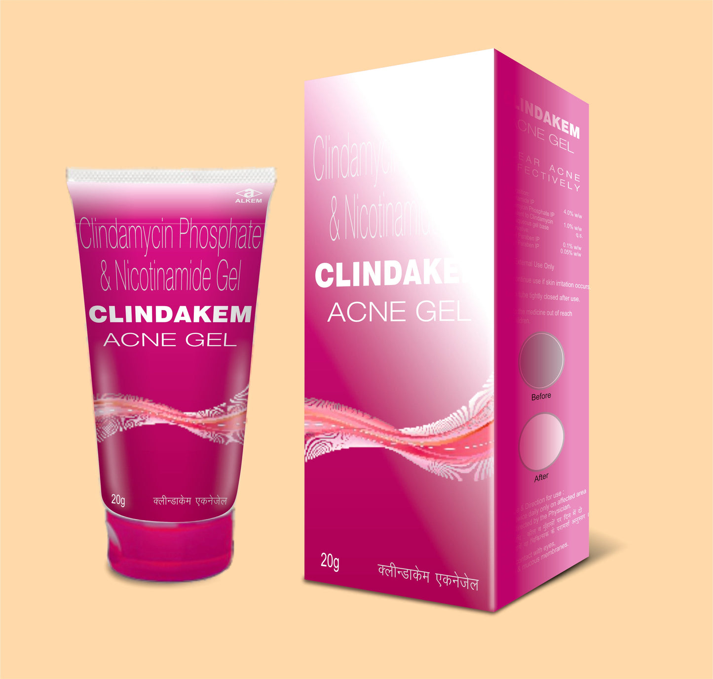 CLINDAKEM 600 INJECTION (1X4ML) AMPOULE (4ml Ampoule  Clindamycin 150 mg + Benzyl Alcohol 9.45 mg by Alkem